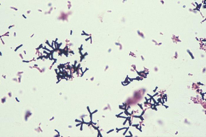 12 Resim 2.2. Bifidobakterilerin ışık mikroskobu görüntüleri [26]. 2.2.2. Fizyolojisi Bifidobakteriler anaerobik mikroorganizmalardır, genellikle % 10 CO 2 li ortamda gelişirler.