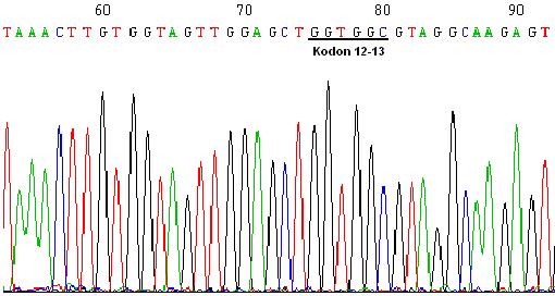 Alptekin ve ark. Ç.Ü. Tıp Fakültesi Dergisi Şekil 2: K-ras geni PCR ürünlerinin Aplied Biosystem 377 DNA Sekans cihazı ile analiz sonucu baz dizilimi (Kodon 12-13 de mutasyon yok).