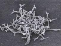 14 2.4. Bifidobacterium Cinsi Bakterilerin Genel Özellikleri İlk kez 1899 yılında Tissier tarafından izole edilen Bifidobacterium lar Actinomycetaceae familyasına dâhildir [Özer, 2006].