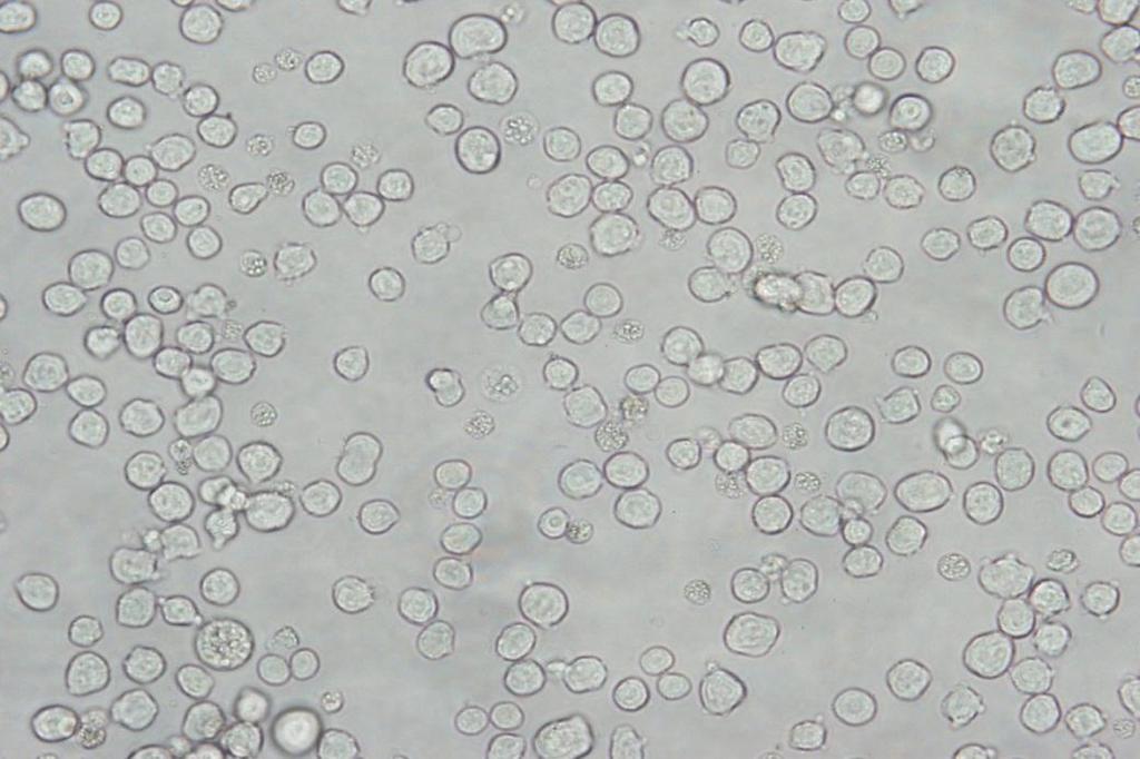 aminopterin hassasiyetlerinin sağlanması amacıyla kültür ortamına 8-azaguanin (20μg/ml) eklenerek kültüre devam edildi (Şekil 3.3). Şekil 3.