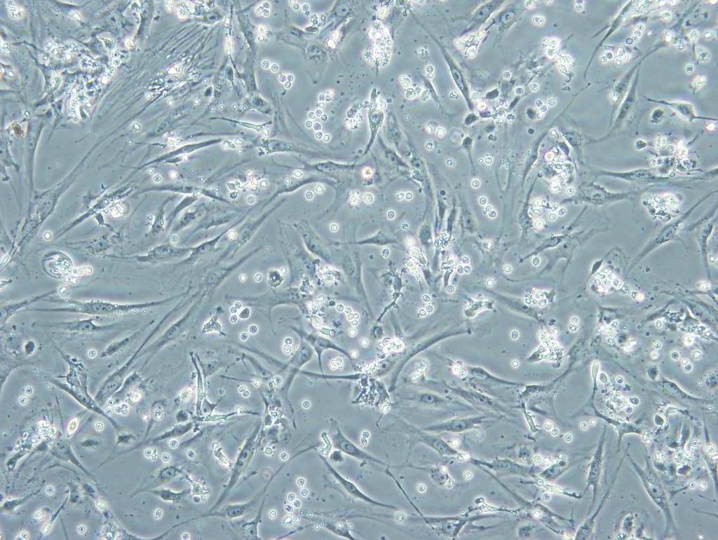 Örnek 1/1 oranında kolajenaz tip II (Sigma-Aldrich, C6885) solüsyonu ile karıştırılarak enzimatik reaksiyon başlatıldı.