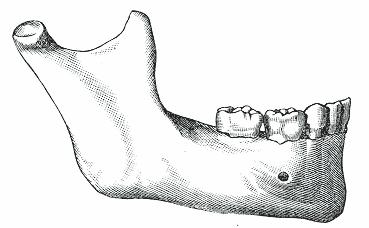 36 Şekil 2. DEXA cihazı ile mandibular kemik mineral yoğunluğu çekimlerinde hasta pozisyonu.