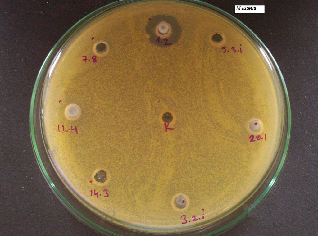 yapıldığı bir projede ( Tunail vd. 1995) de 142 Lactococcus lactis subsp.