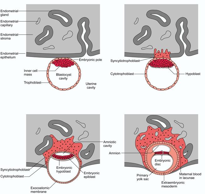 Fertilizasyon sonrası 6. ve 7. gün civarında, trofektodermin direk olarak endometriyumla temasını sağlamak üzere, zona pellusida dejenerasyonu gerçekleşir. Başlangıçta blastokist invaziv değildir.