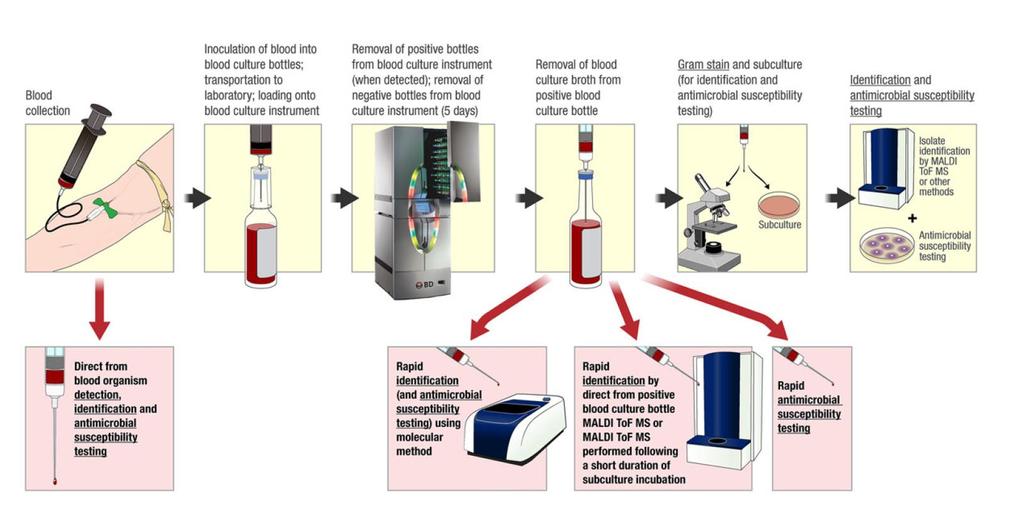 Kan kültürü Pozitif sinyal (5 gün) Gram boyama Tanımlama Duyarlılık testi Doğrudan MALDI-TOF Duyarlılık testi Kandan direk tanı ve duyarlılık testi Kan kültüründen moleküler tanı ve duyarlılık testi