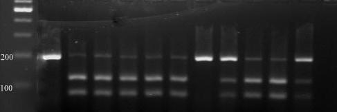 62 M 1 2 3 4 5 6 7 8 9 10 11 Şekil 4.4. p53 72. kodon polimorfizminin BstU1 enzimi ile kesildikten sonra agaroz jelde görüntüsü. M: DNA boyut markırı 100 bç. Hat 1: Kesim yapılmamış.