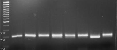 68 M 1 2 3 4 5 6 7 8 Şekil 4.7. MTHFR geni HinfI enzimi ile kesildikten sonra agaroz jelde görüntüsü. M:.DNA boyut markırı: 100 bç, Hat 1: Kesim yapılmamış örnek, Hat 2-3:.