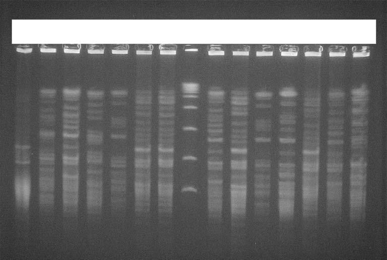 Dolapçı İ, Karahan ZC, Mumcuoğlu İ, Us E, Çöloğlu D, Ulusoy M, Tekeli A. 1 2 3 4 5 6 7 M 8 9 10 11 12 13 14 Resim 2. A.baumannii suşlarının ApaI enzimi ile yapılan PFGE de elde edilen bant modelleri.
