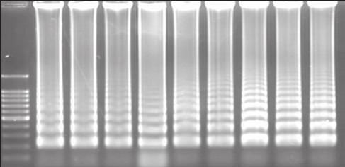 caninum, B. gibsoni, B. Bovis, C. parvum, T. Brucei ve T. Parva protozoonları kullanıldı. Sonuç olarak 60 dakika süren Lamp reaksiyonuyla T.