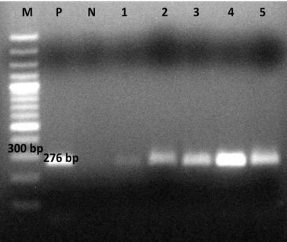 Fidan, Ü. (1993). Recent records on virus diseases of vegetables in greenhouses. Journal of Turkish Phytopathology 22(1): 45-45. Fidan, Ü. (1995).