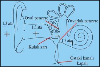 (kilitlenir). İşte bu evreden sonra yapılan eşitleme hareketleri de cevap veremez ve orta kulak dengelenemez.