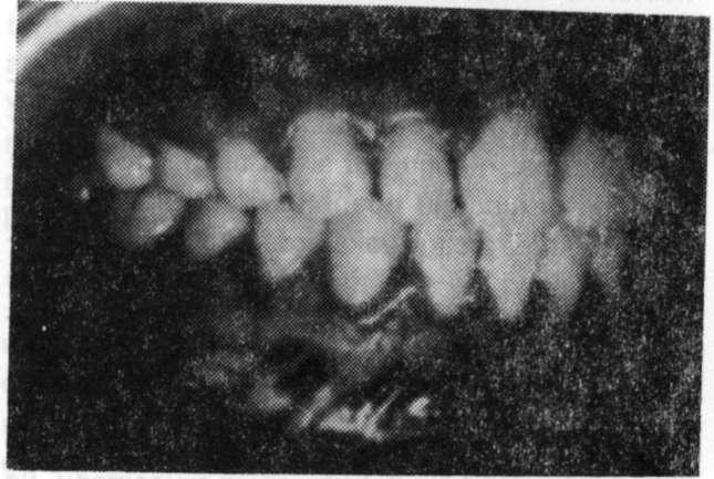 görünüşü. 6. c Resim 6.