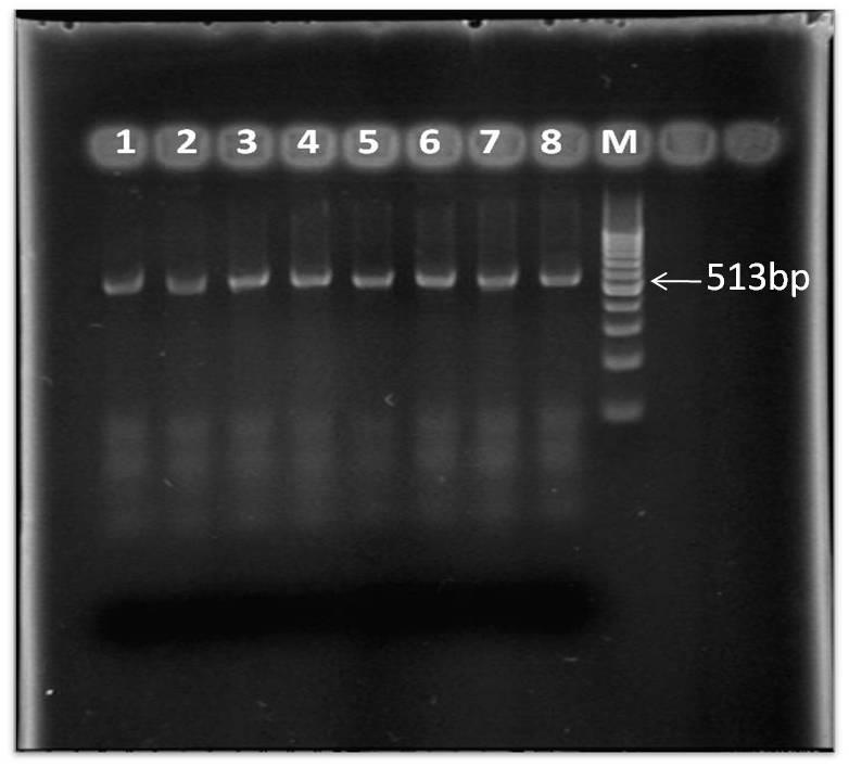 Şekil 4. CMV klıf proteinine özgü primerlerle yapılan RT-PCR sonucunda oluşan 513 bp nin %1.