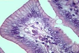 -Apikal yarımları farklılaşmamış prizmatik epitel hücreleri de vardır. Böbreğin duktus kollektivus ları ile safra kesesinin iç yüzünü örten hücreler bu tür epitel hücrelerindendir.