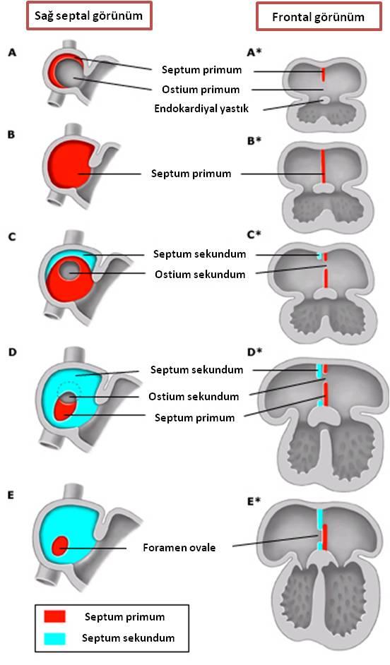 Şekil 2.1. Septum primum ve sekundum embriyolojik gelişim aşamaları Atriyal septal defektler, embriyolojik ve anatomik lokalizasyonuna göre sınıflandırılırlar.