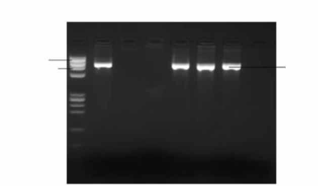 Görgeç S, Kuzucu Ç, Otlu B, Yetkin F, Ersoy Y. M 1 2 3 4 5 6 NK 1353 bç 872 bç 909 bç esim 1. PC ile CTX-M pozitif suşların jel elektroforez görüntüsü [M: Ağırlık belirteci (0.072-1.