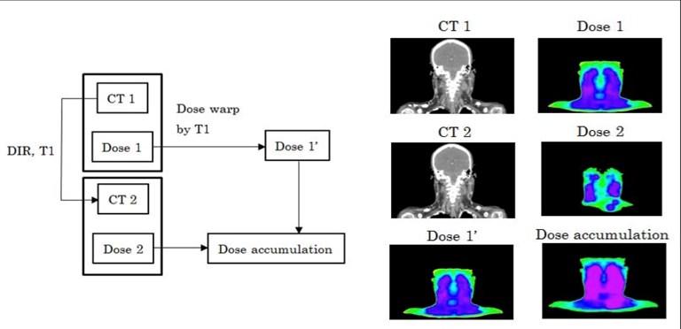 Normalde toplam dozu aynı planlama CT si üzerinde görebiliyoruz. Bununla birlikte DIR sayesinde farklı planlama CT leri (veya CBCT ler) üzerindeki dozun da toplamda görülme şansı ortaya çıktı.