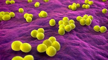 Hastane mikroplarıyla enfeksiyon riski(mrsa) ca. 15.000 ölüm/yıl (acc. RKI) 400.000 600.000 enfeksiyon/yıl (acc.