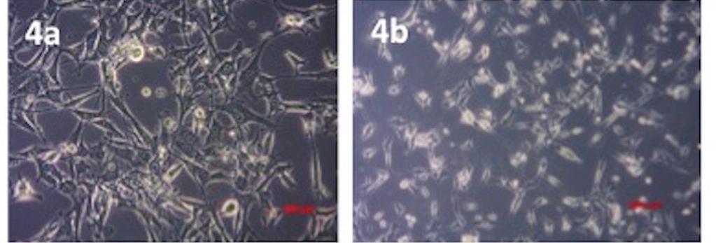 Direkt kültüre edilen HepG2 hücrelerinin faz kontrast mikroskop altında çekilen fotoğrafları. Bir haftalık kültürün ardından fikse edilen hücreler Hematoksilen ve Eozin ile boyandı.