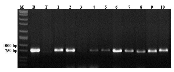 ile teyit edilmesi M) Markör (DNA ladder), B) Bakteri plazmid DNA sı, T) Tütün negatif kontrol, 1-11 kulvarlar transgenik tütün bitkileri