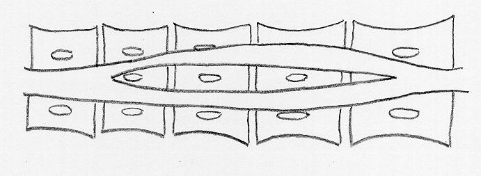 Ok her iki hemicord arasýndaki fibröz septayý göstermektedir.