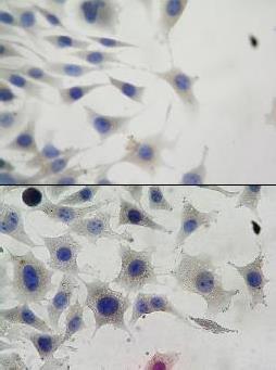 L929 FIBOBLAST DİZİN HÜCELEİNDE PEMF IÇIN YAA İYİLEŞMESİNE ETKİSİ 6 5 PEMF/Kontrol PEMF/Uygulama 4 3 2 İyileşme PBS enos inos TGF-beta Şekil 6: Mikroskopta izlenen hücrelerin yara iyileşmesindeki