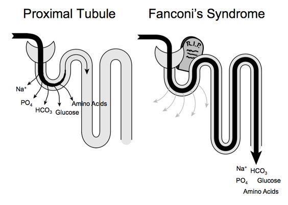 Fanconi Sendromu TDF alanlarda insidansı % 0.