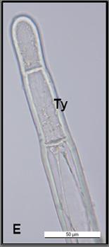 örtü tüyleri Bar = 100 µm E.