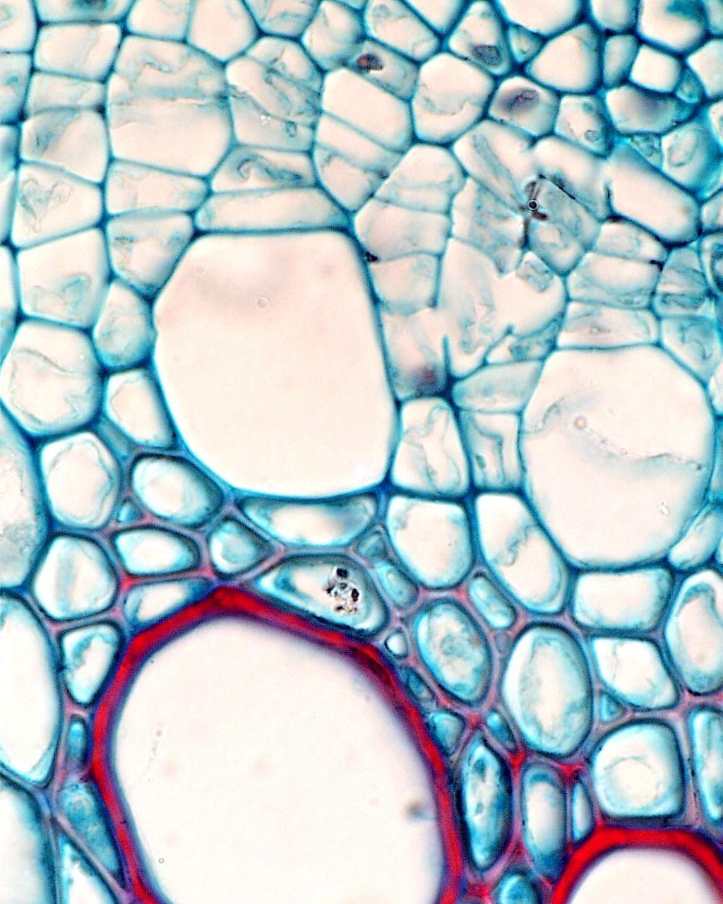 Trake Farklılaşması Apoptosis