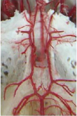 Pekok ÇH, Aycan K, Ülger H ve ark. A B Şekil 1. A. cerebri rostralis lerin birleşerek median cerebral arteri oluşturduğu a.