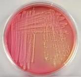 Columbia agar