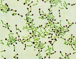 Corynebacterium diphtheriae Gram pozitif, haraketsiz,