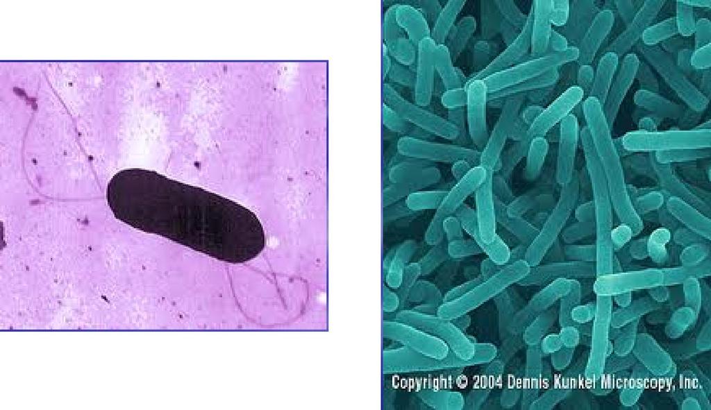 LISTERIA Çevrede yaygın olarak bulunan bir bakteridir.