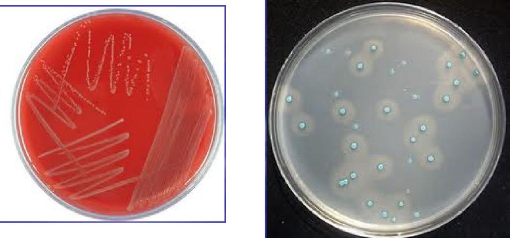 Listeria lar kan içermeyen besiyerlerinde de üreyebilirse de koyun kanlı besiyerinde izolasyonu daha