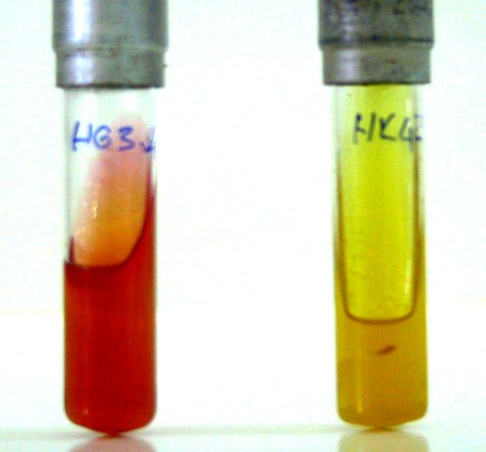 51 Pozitif C. jejuni Negatif Kontrol Pozitif Kontrol C. jejuni Şekil 2.5. Campylobacter jejuni şüpheli izolatın hippurat hidroliz testi görünümü. 2.6.