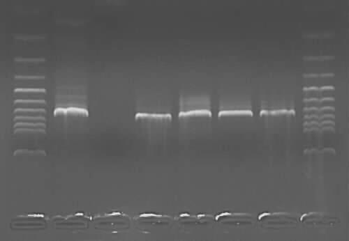 56 işlem sonunda, elde edilen spesifik DNA bantları UV-Transilluminator (Biometra TI1 UV 9511011) ve jel görüntüleme sistemlerinde (Syngene Ingenius, Cambridge, İngiltere) pozitif kontroller ve