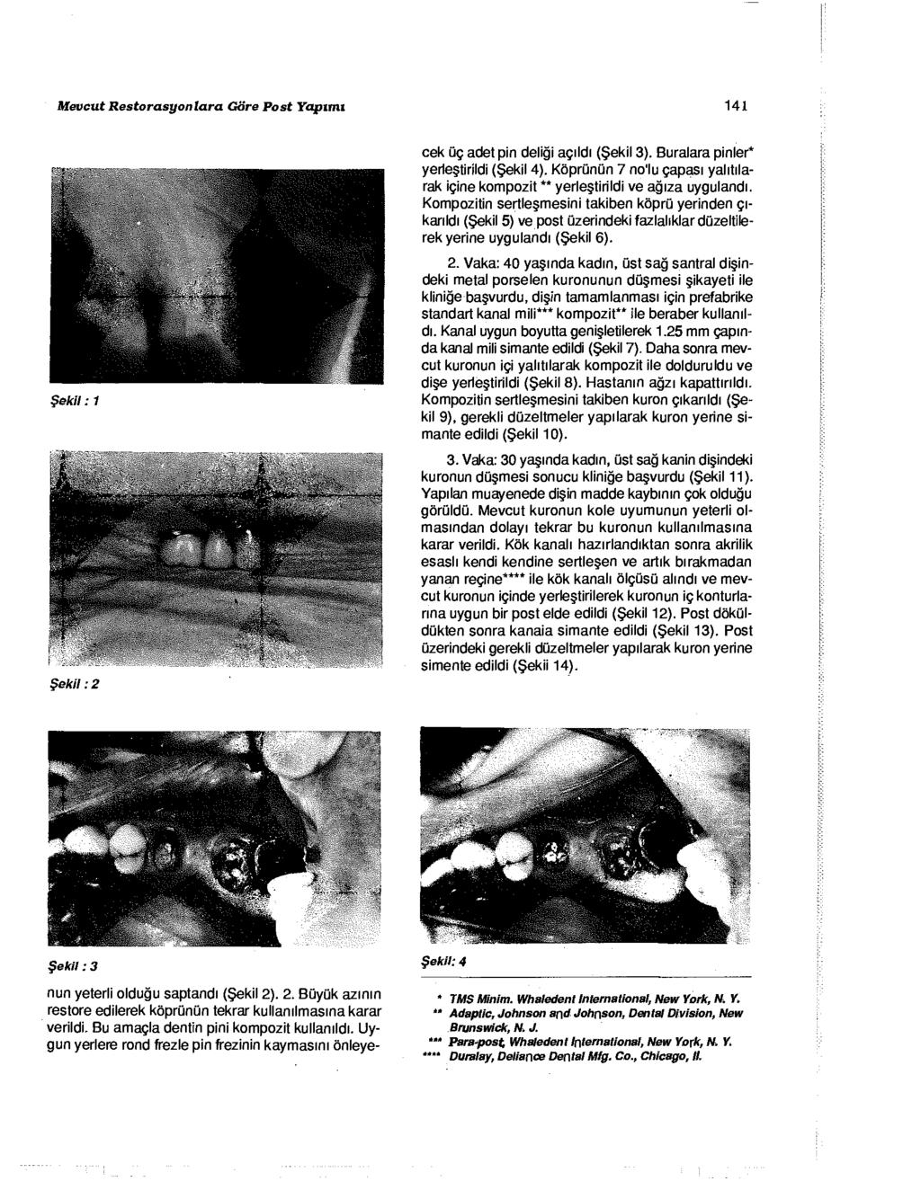 Mevcut Restorasyonlara Göre Post Yapımı 141 nun yeterli olduğu saptandı (Şekil 2). 2. Büyük azının restore edilerek köprünün tekrar kullanılmasına karar verildi.