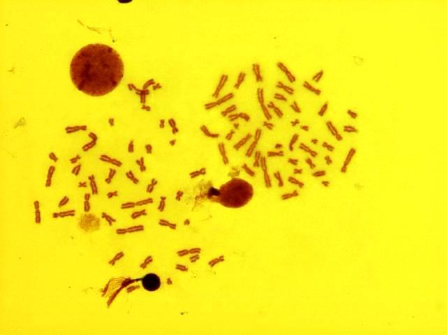 4. BULGULAR VE TARTIŞMA Fezel NİZAM 10µm Şekil 4.16.