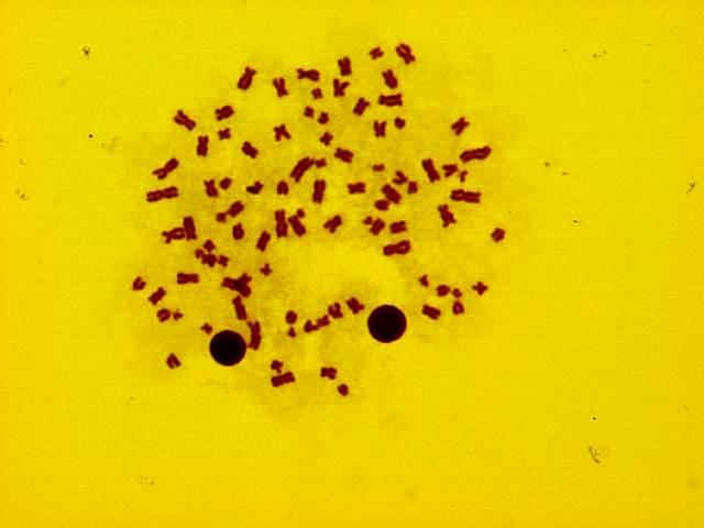 4. BULGULAR VE TARTIŞMA Fezel NİZAM 10µm Şekil 4.20.Poliploid hücre kromozomları ( 20 µg/ml + S9 mix, 3 
