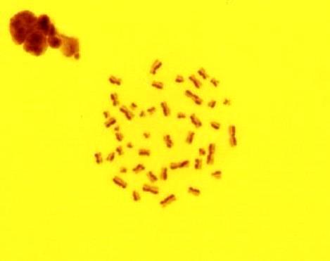 kromozomları (X1000). 10 µm Şekil 3.5.
