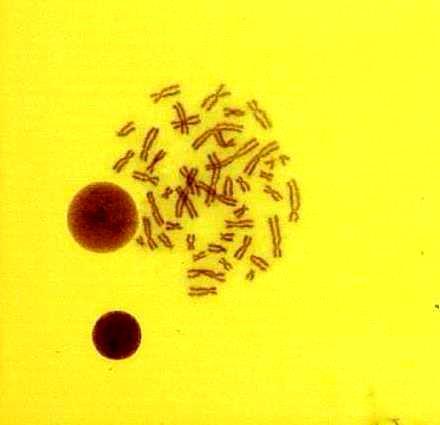 4. BULGULAR VE TARTIŞMA Fezel NİZAM 10µm Şekil 4.3.