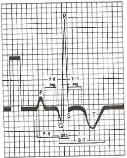 12 kenarı), CV 6 LU (altıncı interkostal aralığın kostakondral birleşim yeri), V 10 (yedinci sırt omurunun dorsal spinosusu üzeri) dur (Detweiler, 1989).