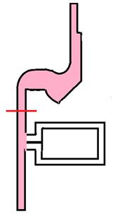 Ayrıca dünyada uygulanan farklı ameliyat teknikleri de vardır. Bunlardan bazıları biliopankreatik diversiyon ve duodenal switch tir.