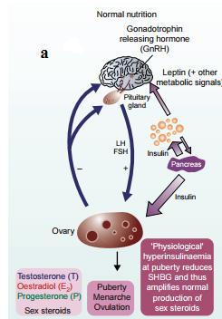 Şekil 1.2. İnsülin direncinin üreme sistemi üzerine etkileri ( Sharpe ve Franks, 2002) Hormonal mekanizmalar beslenme ile ilişkilidir.