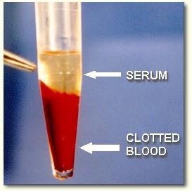 Klinik Biyokimya da en sık başvurulan materyal Kan ve İdrardır Tam kan: Serum veya plazması ayrılmamış kan.