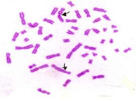 Tablo 12: Kontrol grubunda kromozom aberasyonu bulguları Kültür: 48 saat, Değerlendirilen Hücre sayısı: 100 Yapısal kromozom aberasyonları Toplam Gözlemlenen Kromatid Kromozom Asentrik Yaş Cins