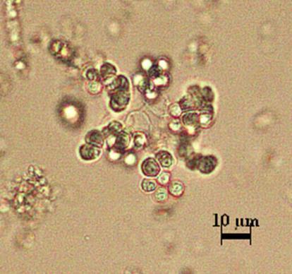 Bazen 95 µm genişliktedir. Dizilmiş, birleşik bir halde bulunurlar.