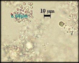 3-2 µm büyüklükte, renksiz ya da mavi yeşil renkte ve özel bir kılıfla