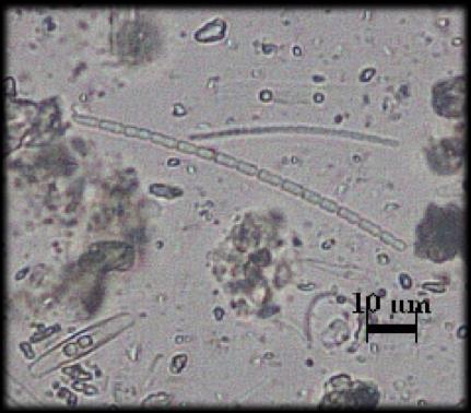 Şekil 5.34. Pseudanabaena limnetica Ordo: Oscillatoriales Familya: Oscillatoriaceae Genus: Oscillatoria Oscillatoria limosa Ag.