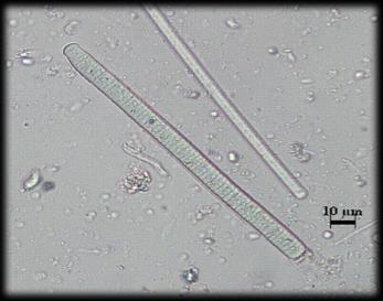 Şekil 5.36. Oscillatoria rubescens Oscillatoria tenuis C.A.